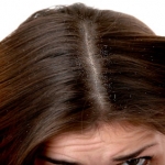 Problemi di forfora? Ecco un rimedio efficacie e naturale