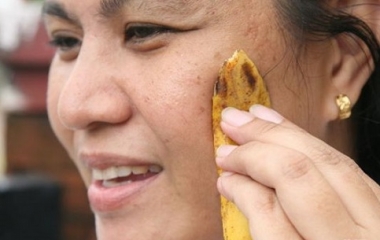bucce di banana