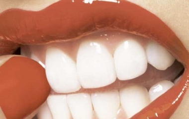 sbiancare-i-denti